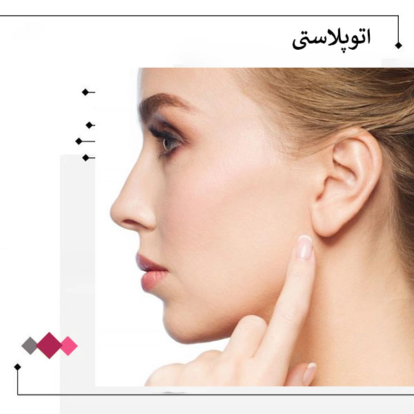 اتوپلاستی یا جراحی زیبایی گوش _ دکتر مریم اعتمادی