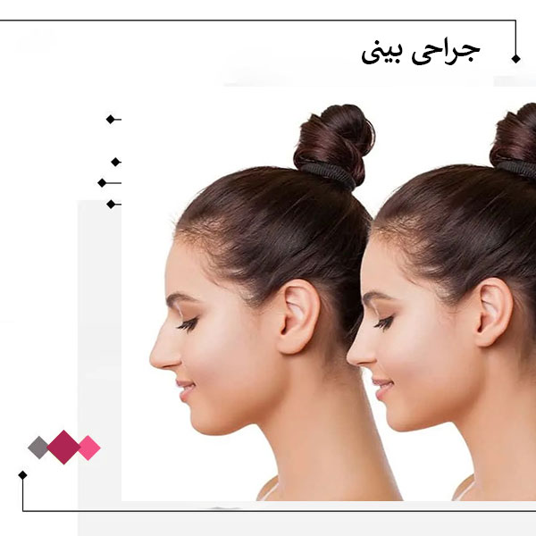 جراحی بینی _ دکتر مریم اعتمادی