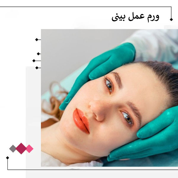 ورم بیینی بعد از عمل _ دکتر مریم اعتمادی