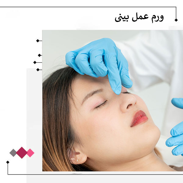 ورم بیینی بعد از عمل _ دکتر مریم اعتمادی